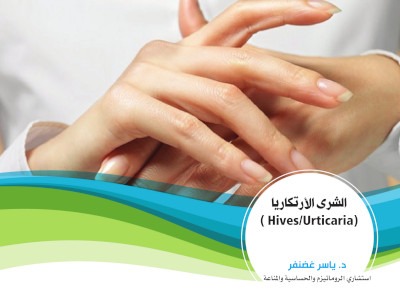 Urticaria.jpg